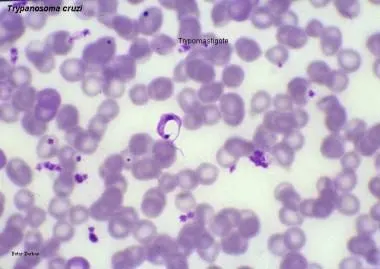 Chagas Disease Research - Epitope Prediction